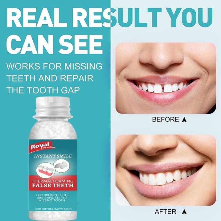 PEGAMENTO DENTAL MOLDEABLE INSTANTANEO